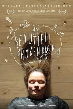 My Beautiful Broken Brain
